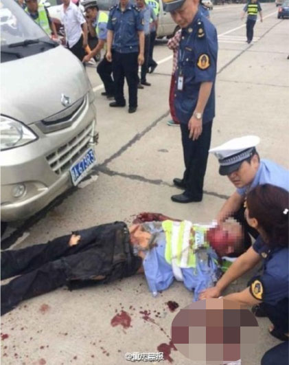 Cảnh sát Su bị thương nặng sau khi được đưa từ gầm xe minivan ra.