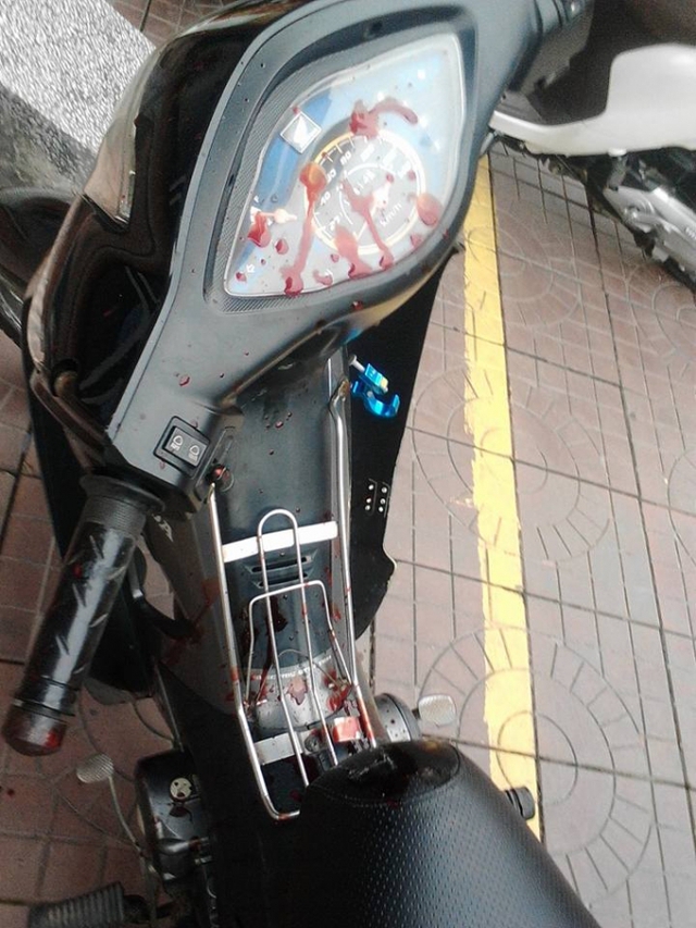 
Chiếc xe máy của người thanh niên bị đánh, với nhiều vết máu trên xe. (Nguồn: Facebook)
