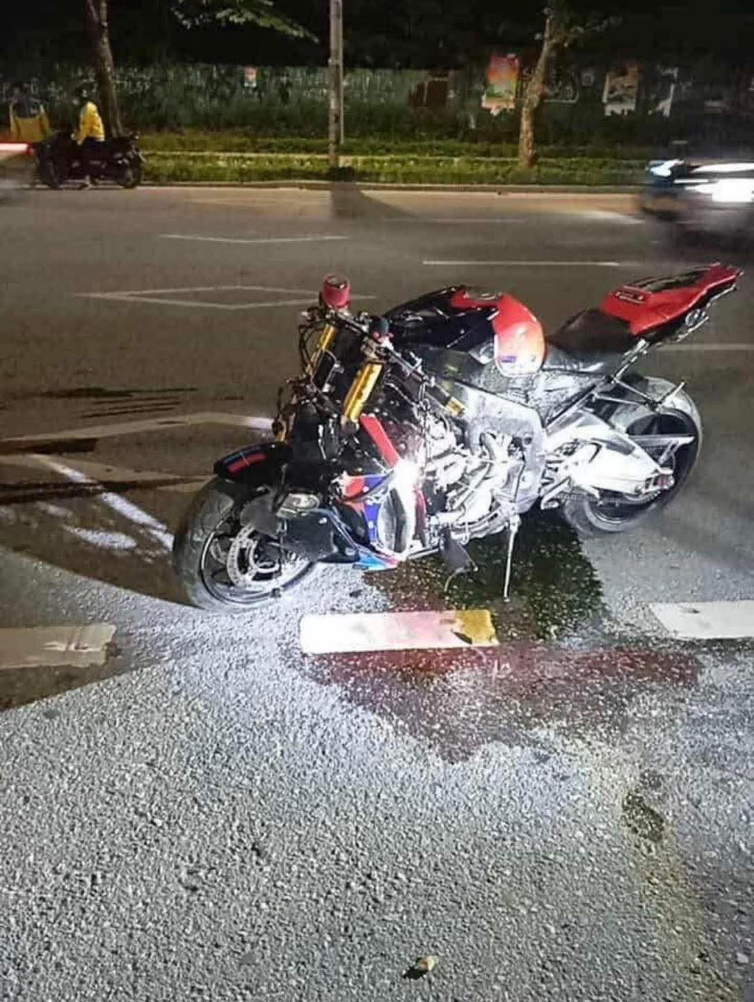 Kỳ tích 6 tiếng nối lại chân cho cô gái 19 tuổi sau tai nạn kinh hoàng với xe phân khối lớn ở Hà Nội- Ảnh 1.