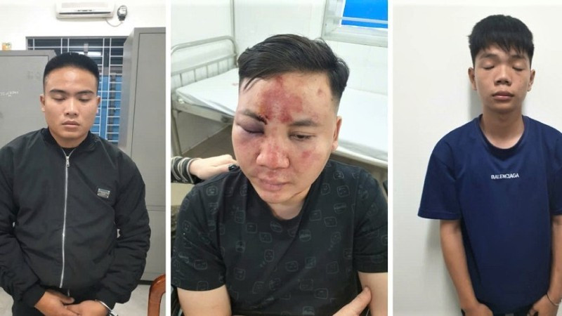 Vụ “ô tô điên” lao vào đám đông ở Nghệ An trong buổi khai trương quán bún ốc: Có dấu hiệu của nhiều tội danh- Ảnh 1. Vụ “ô tô điên” lao vào đám đông ở Nghệ An trong buổi khai trương quán bún ốc: Có dấu hiệu của nhiều tội danh- Ảnh 1.