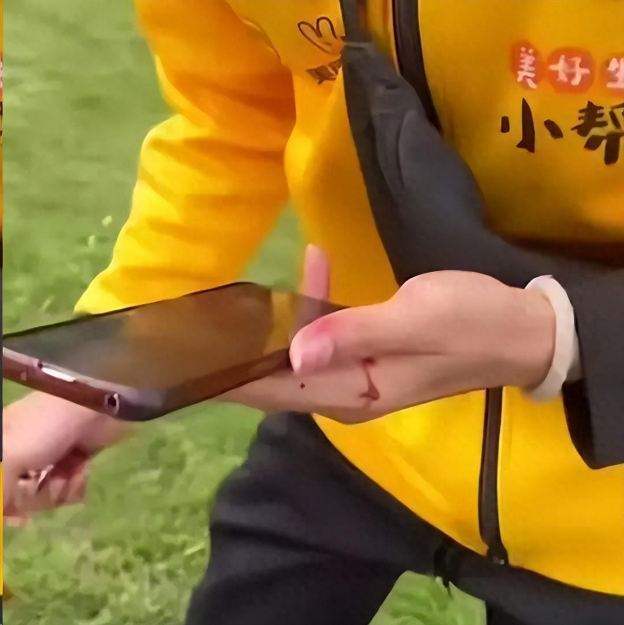 Shipper t&ocirc;ng hỏng xe Porsche, bật kh&oacute;c giữa đường nhưng chủ xe kh&ocirc;ng bắt đền, c&ograve;n đ&ograve;i chi trả viện ph&iacute;: Nhờ 1 c&acirc;u n&oacute;i!- Ảnh 1.