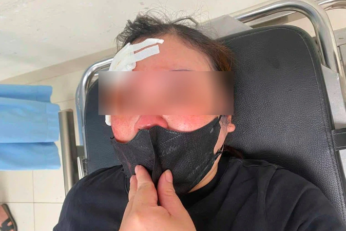 Người tr&ecirc;n &ocirc; t&ocirc; b&aacute;n tải bị tố vụt d&ugrave;i cui v&agrave;o đầu nữ t&agrave;i xế n&oacute;i g&igrave; về nguy&ecirc;n nh&acirc;n?- Ảnh 1.