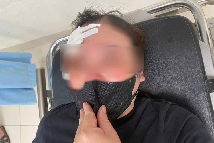 Người phụ nữ đi xe m&aacute;y "tố" bị t&agrave;i xế xe b&aacute;n tải d&ugrave;ng d&ugrave;i cui vụt v&agrave;o đầu- Ảnh 1.