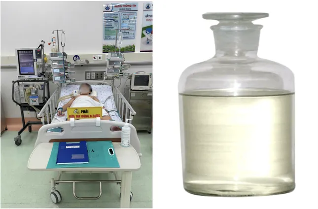Hít phải khí kịch độc trong xe hơi, bé trai nguy kịch