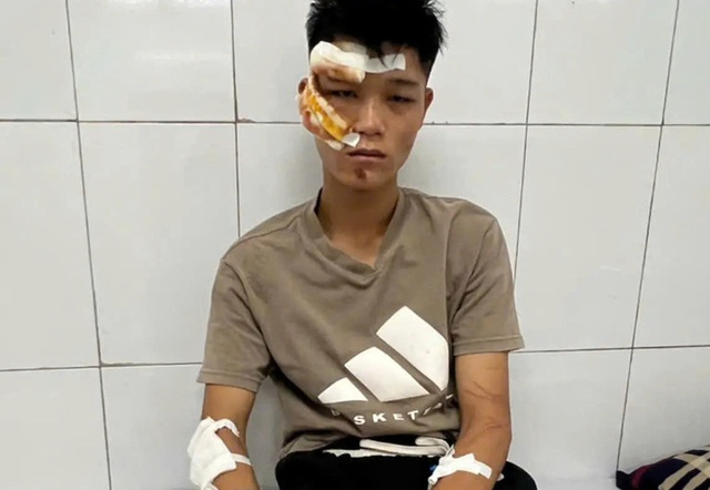 "Quái xế" khóc và khai về việc đi vào đường cấm, tông chiến sĩ cảnh sát cơ động- Ảnh 1.