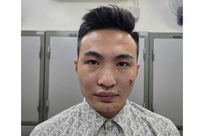 Lời khai bất ngờ của nam thanh niên sinh năm 2003 say xỉn, lái xe máy tông ngã cán bộ Công an làm nhiệm vụ A80- Ảnh 1.