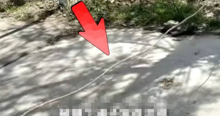 Đạp xe vướng d&acirc;y giăng ngang đường, cậu b&eacute; bị siết cổ đến vỡ kh&iacute; quản, nguy kịch- Ảnh 1.