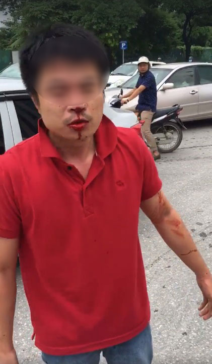 Hà Nội: Tài xế Hyundai Grand i10 bị đấm chảy máu mặt sau va chạm giao thông - Ảnh 2.