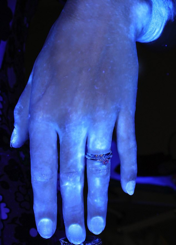 Hình ảnh gây sốc cho thấy bàn tay bạn nhiều vi khuẩn như thế nào và vai trò của việc rửa tay đúng kỹ thuật trong phòng tránh COVID-19 - Ảnh 4.