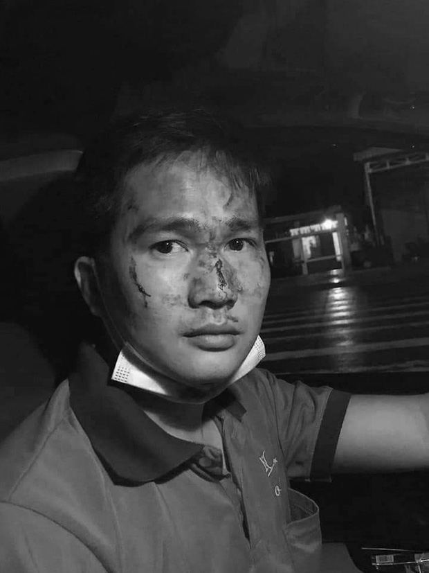 Thanh niên đánh tài xế taxi đổ máu ở Bình Phước đã đưa vợ, con rời khỏi nơi tạm trú - Ảnh 2.