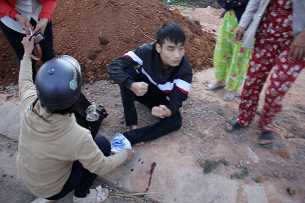 
Một nạn nhân tại thị trấn Đắk Hà bị xe điên tông đang ngồi bên vệ đường đợi xe cấp cứu. Ảnh do bạn đọc cung cấp
