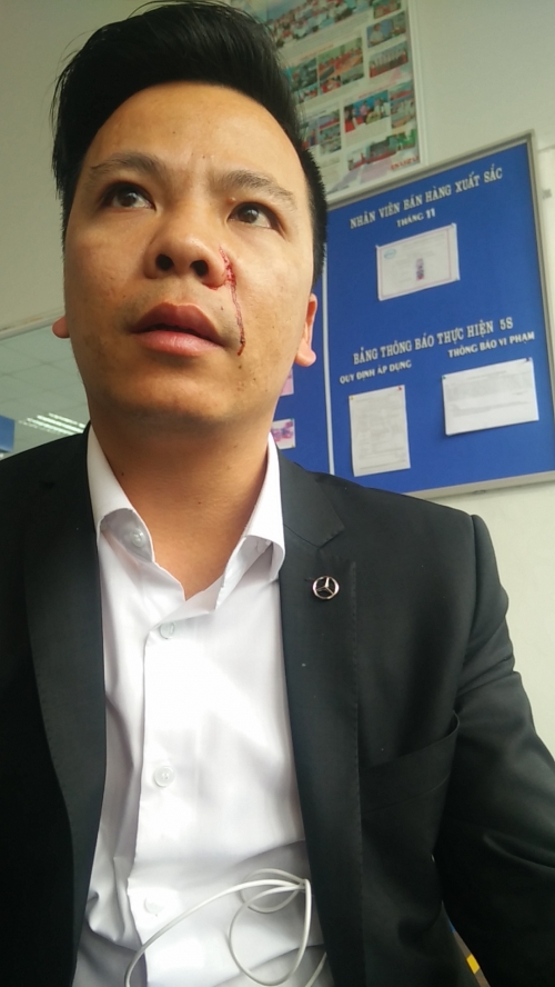 
Anh Đặng Xuân Trịnh, khách hàng bị nhân viên kinh doanh của Isuzu Long Biên đánh.
