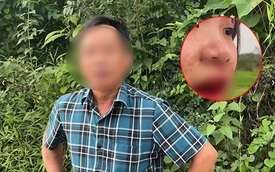 Vụ cô gái tố tài xế ô tô hành hung chảy máu mồm: Người đánh là cán bộ xã