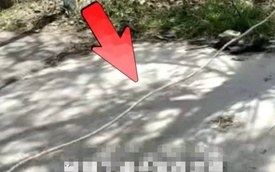 Đạp xe vướng dây giăng ngang đường, cậu bé bị siết cổ đến vỡ khí quản, nguy kịch