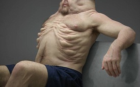 Nếu muốn sống sót trong các vụ tai nạn giao thông, bạn phải có cơ thể như thế này