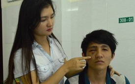 Thanh niên tự "đập mặt" vào gậy CSGT khiến hốc mắt bị lún