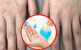 Lạm dụng nước rửa tay khô trong mùa dịch COVID-19: chuyên gia cảnh báo có thể gây tổn thương đến đôi tay