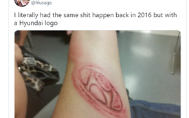 Sau tai nạn, tài xế hài hước “khoe” những vết bầm hình logo xe trên cánh tay